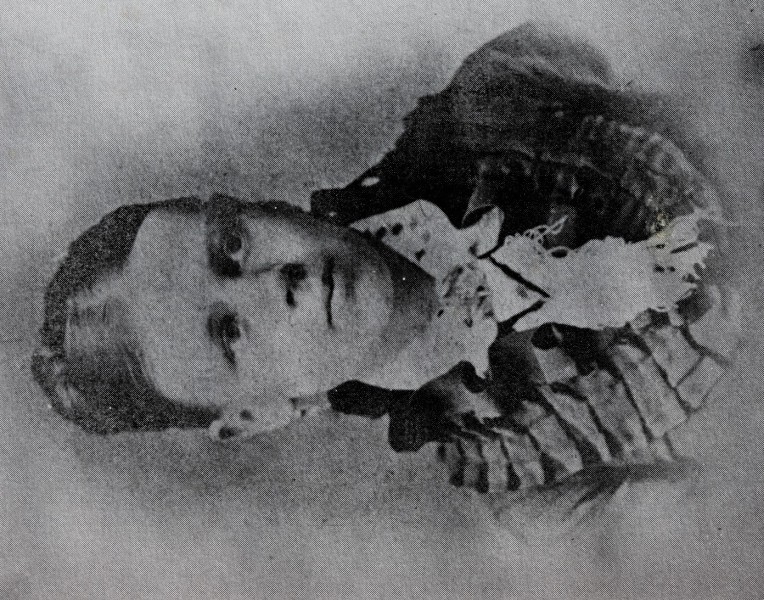 Anne Whittaker